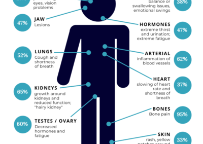Recognizing Erdheim-Chester Disease Early: Why Awareness Matters