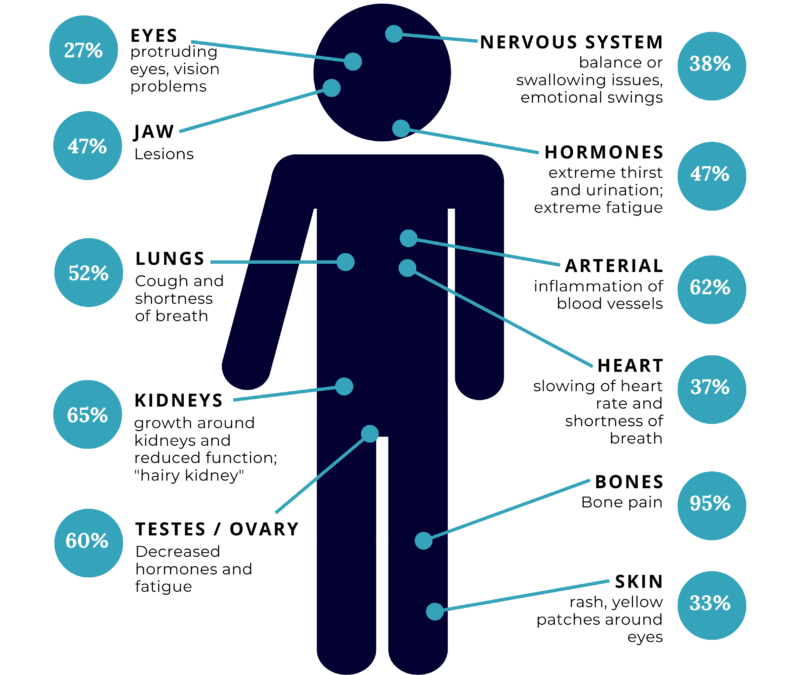 Recognizing Erdheim-Chester Disease Early: Why Awareness Matters