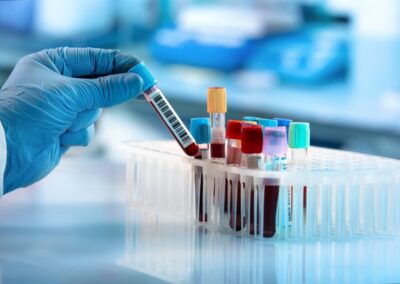 Breaking New Ground in Erdheim-Chester Disease Research